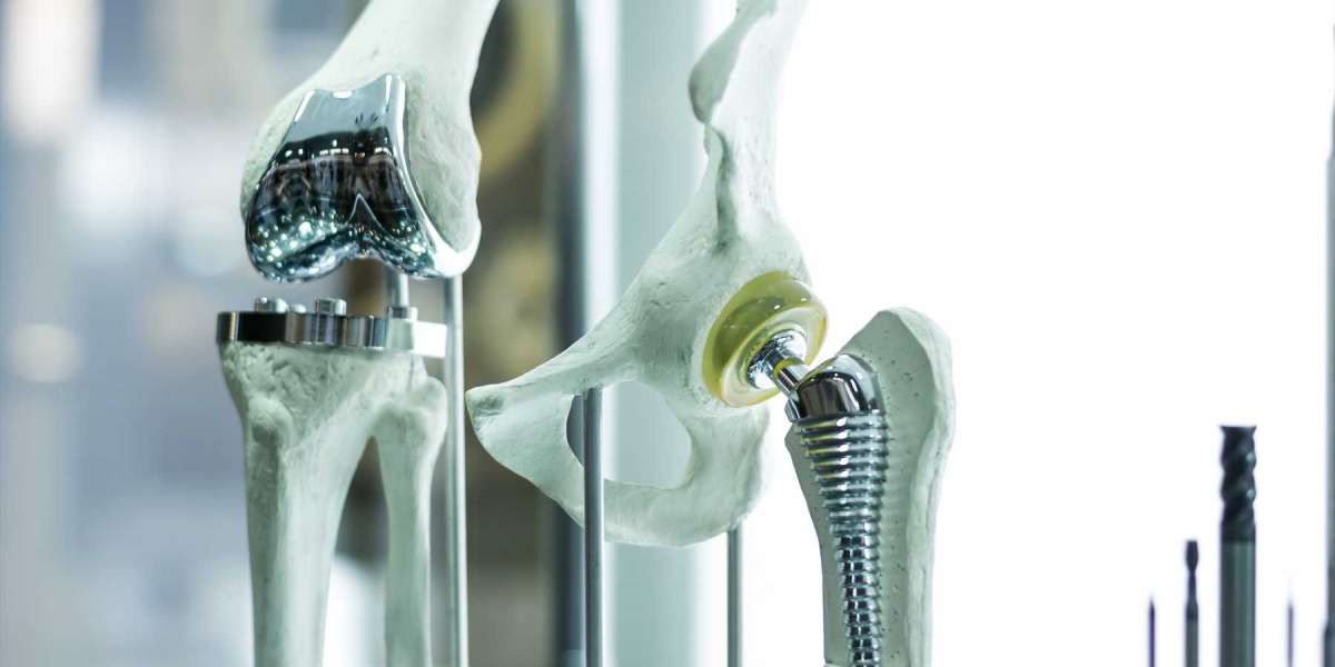 Industry to Register 12.30% CAGR during 2023-2032; Asserts America Orthopedic Biomaterial Market Insights