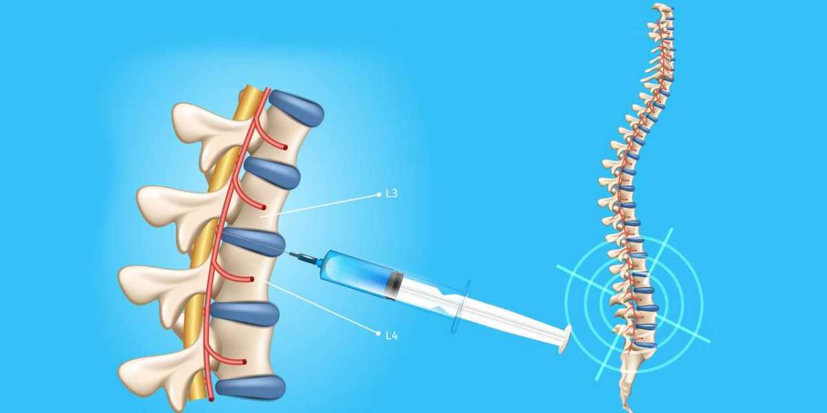 Global Spinal Needles Market Insights with CAGR values, SWOT Analysis & Future Scope